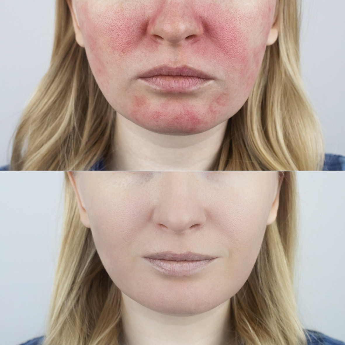 Crème Soin Couperose – Image 2